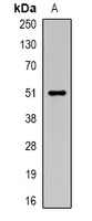 Anti-Carboxypeptidase A6 Antibody