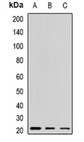 Anti-Alpha-crystallin A Antibody