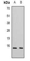 Anti-CXCL11 Antibody