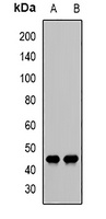Anti-Decorin Antibody
