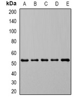 Anti-DHODH Antibody