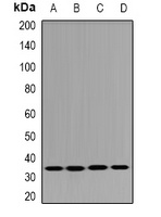Anti-DHRS9 Antibody
