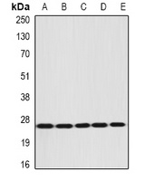 Anti-DIRAS3 Antibody