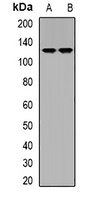 Anti-DLGAP5 Antibody