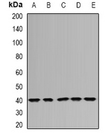 DNAJB6 antibody