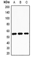 Anti-TdT Antibody