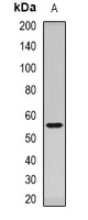 Anti-Dopamine Receptor D5 Antibody