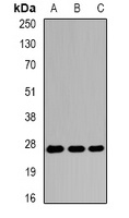 Anti-EIF6 Antibody
