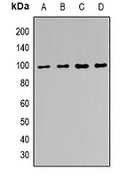 Anti-EZH2 Antibody