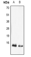 Anti-FABP5 Antibody