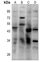 FCGR3B antibody