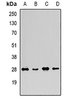 Anti-FGF14 Antibody