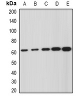 Anti-GNS Antibody