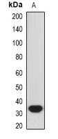 Anti-HO-1 Antibody
