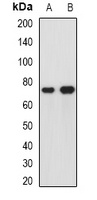 Anti-hnRNP R Antibody