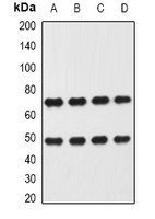 Anti-Heparanase Antibody