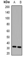 HUS1 antibody