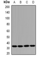 Anti-HUS1B Antibody