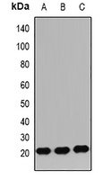 Anti-IGF2 Antibody