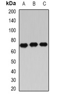 Anti-IGF2BP3 Antibody