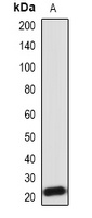 Anti-IL-18 Antibody