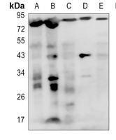 IL1 Receptor antibody