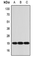Anti-IL-21 Antibody