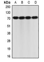 Anti-IL-23R Antibody