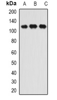 INTS6 antibody