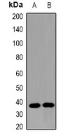 Anti-Omentin Antibody