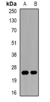 Anti-Kallikrein 1 Antibody