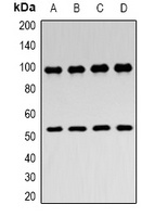 Anti-ZASP Antibody