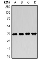 LDHA antibody