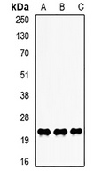 Anti-LITAF Antibody