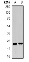 Anti-LY86 Antibody