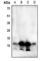 Anti-LC3A/B Antibody