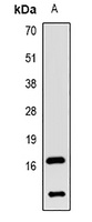 MAP1LC3B antibody