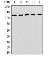 Anti-MBTPS1 Antibody