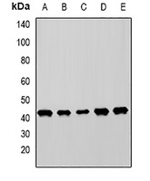 Anti-MICA Antibody