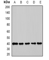 Anti-GBL Antibody