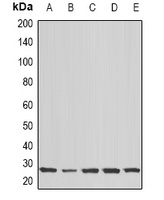 Anti-COX2 Antibody