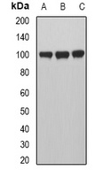 Anti-MVP Antibody