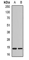Anti-MYL2 Antibody