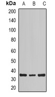 Anti-Calsarcin 1 Antibody