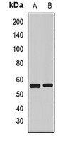 Anti-Visfatin Antibody
