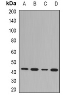 Anti-NDRG1 Antibody