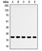 NDUFB5 antibody