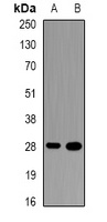 NR0B2 antibody