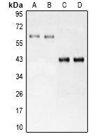 NR5A2 antibody