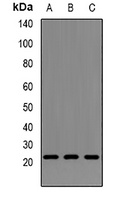 Anti-Neurotrophin 4 Antibody